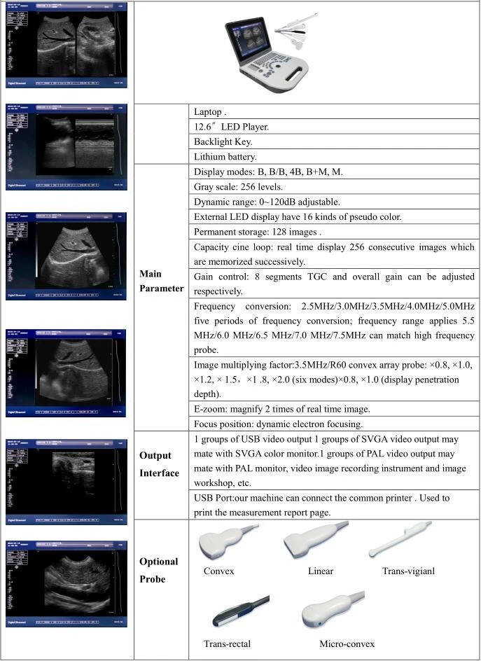 Ultrasound
