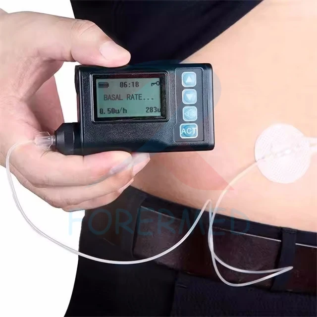 Ponp perfusion ensilin