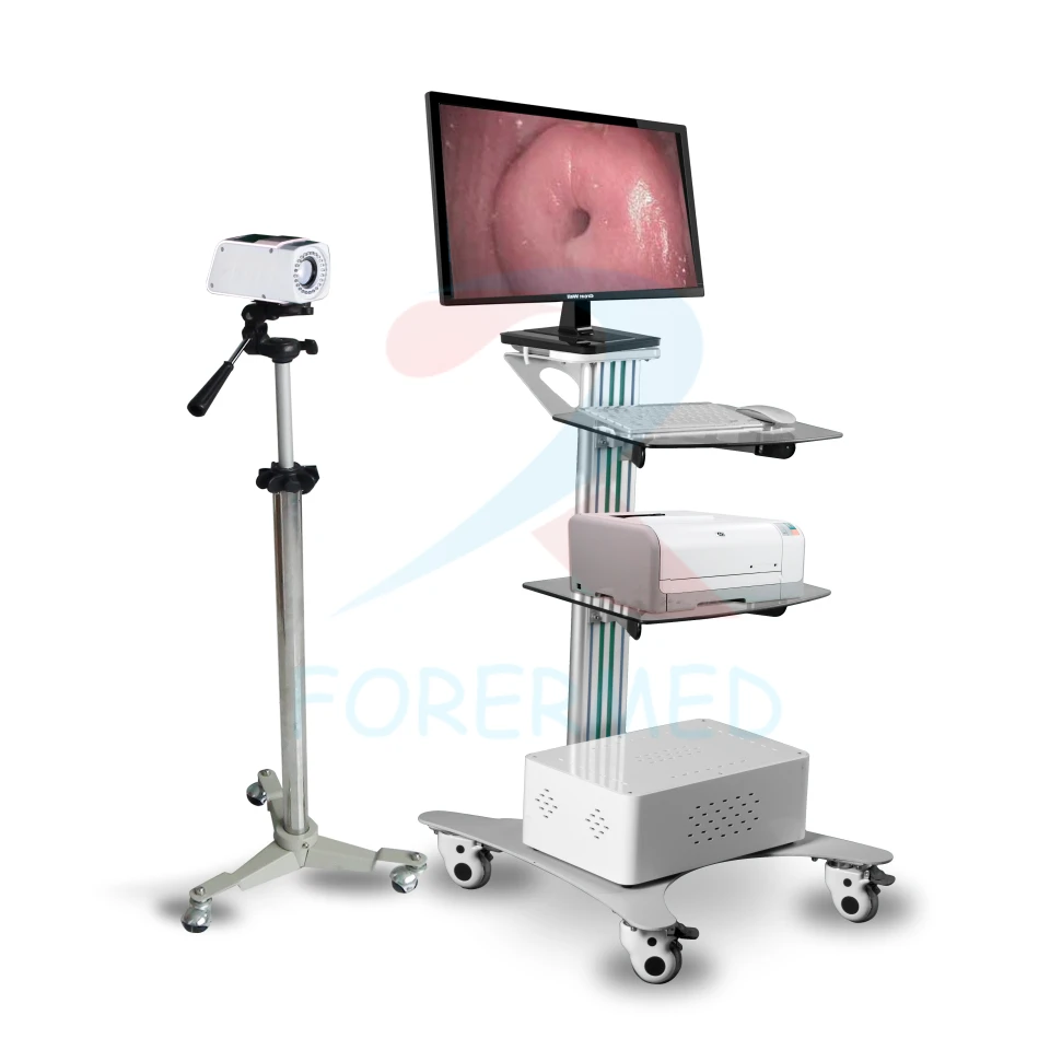Mobil jinekolojik colposcope