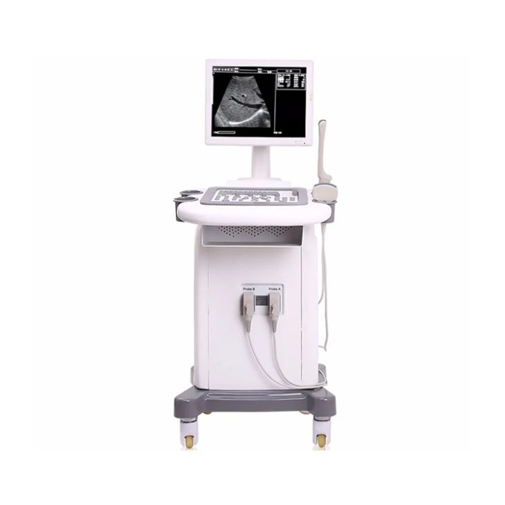 Digital Camera Ultrasound Diagnosis Equipment Digital Camera Ultrasound Diagnosis Equipment