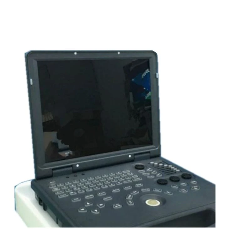 Sonogram Ultrason