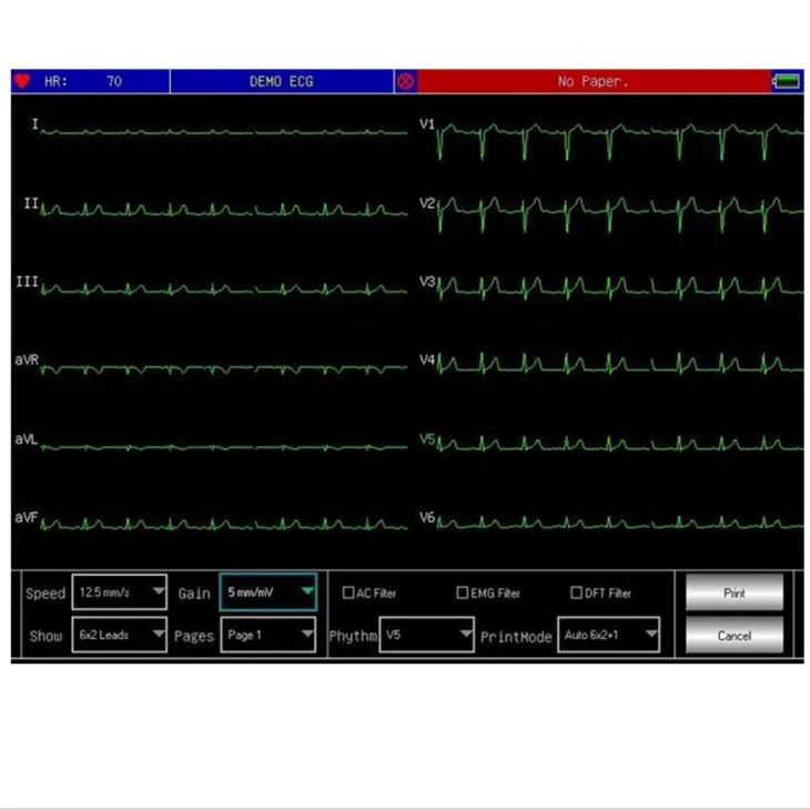 12 channel Hospital Used ECG, EKG Machine