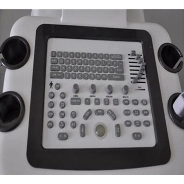 Double Screen Economical Ultrasound Machine