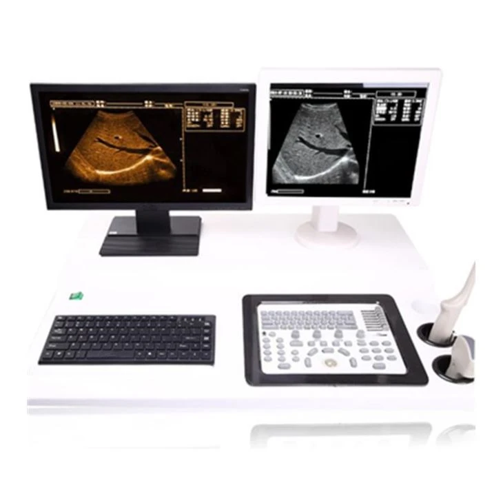 Double Screen Economical Ultrasound Machine