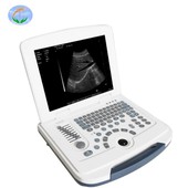 Portable Digital ultrasons machin