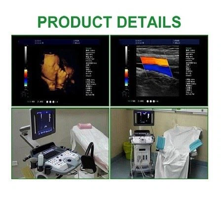 4D Color Doppler Ultrasound Diagnostic System 4D Color Doppler Ultrasound Diagnostic System