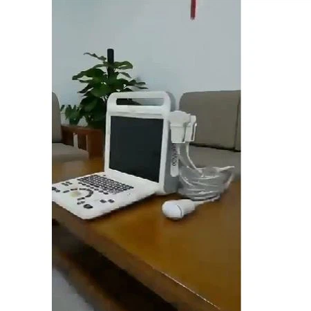 4d Medical Ultrasound Instruments Laptop