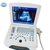 Full-Digital Laptop Ultrasound Scanner