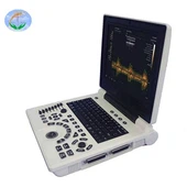 Laptop Koulè Doppler Ultrasond Pou Klinik