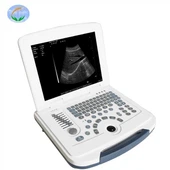 Vèsyon Full-Digital Laptop Ultrasound Scanner
