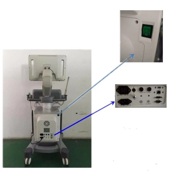 TROLLEY COLOR DOPPLER USG