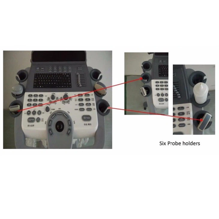 ULTRASOUNND SCANNER