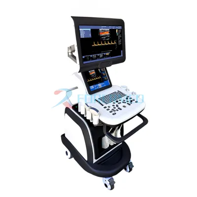 4D Koulè Doppler Ultrasound